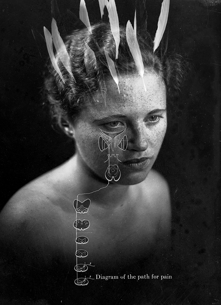 Woman with feathers in her hair and a diagram of the path for pain